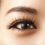 Asian Eyelid Surgery San Francisco & Palo Alto CA Asian Eyelid Surgery San Francisco & Palo Alto CA