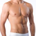 liposuction patient