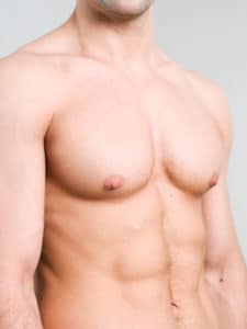 Male Breast Reduction Palo Alto CA | Gynecomastia