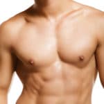 Gynecomastia Palo Alto CA