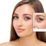 Blepharoplasty San Francisco CA